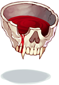 Blood In Skull